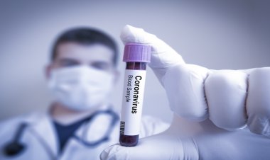Genç Hastalar Da Dâhil Kalp Damar Hastalığı Olanlar COVID-19 Döneminde Daha Yüksek Risk Altında