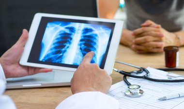 Akciğer Kanserinde Yeni Tedaviler Yaşam Kalitesini Arttırıyor