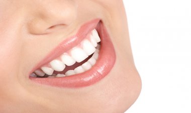 Kişiye Özel Estetik Gülüş Tasarımı