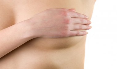 Meme Kanseri Hastalarının Ameliyatını Kolaylaştıran Yöntem: Sentinel Lenf Nodu