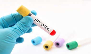 AIDS Bir Hastalık Değil Bir Sendrom