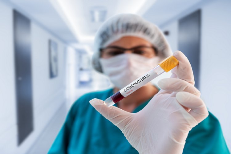 SALGIN KONTROL ALTINA ALINANA KADAR ZORUNLU DURUMLAR DIŞINDA EVDE KALIN