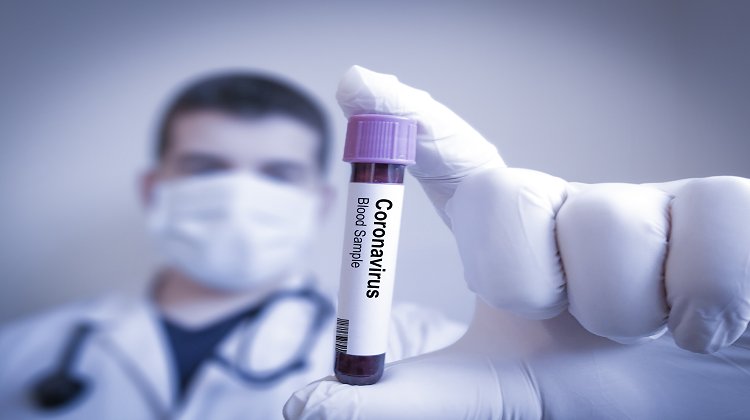 Koronavirüs Kaygısıyla Başa Çıkmanın Yolları