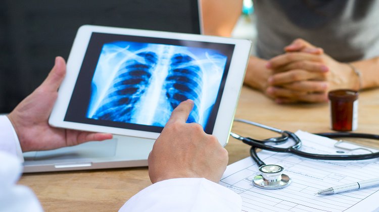 Akciğer Kanseri Tedavisinde Uygulanan VATS Yöntemi Nedir?