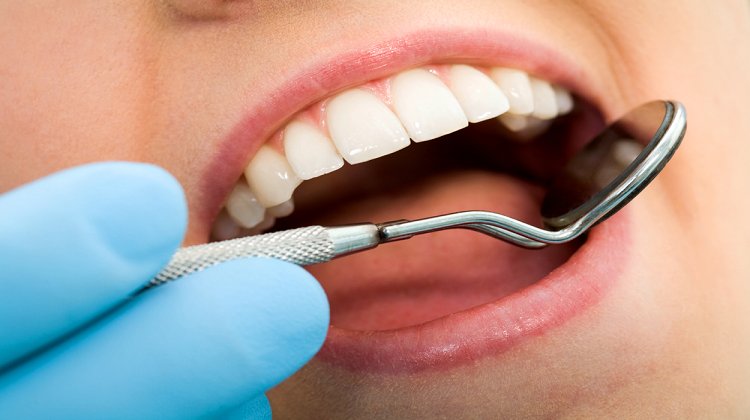 Diş Implantları