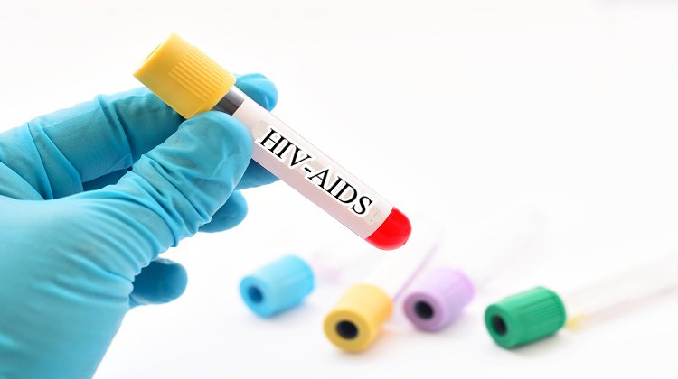 HIV Nasıl Bulaşır? HIV Enfeksiyonu ile AIDS Arasındaki Fark Nedir?