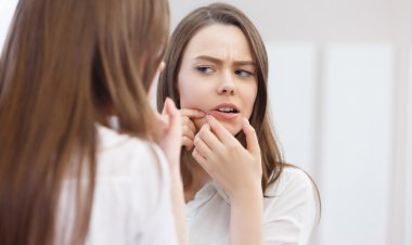 Akne Neden Olur, Nasıl Tedavi Edilir?