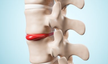 Güçlü Kemikler İçin Bu Önerilere Kulak Verin