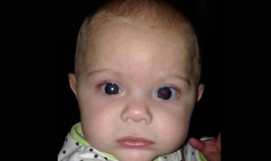 Çektiği Fotoğrafla 4 Aylık Oğlunun Göz Kanseri Olduğunu Öğrendi