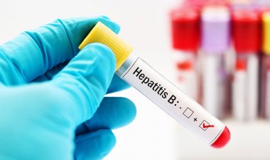 Hepatit Tedavi Edilmezse Siroza Dönüşüyor! İşte Hepatiti Önleyecek Tavsiyeler