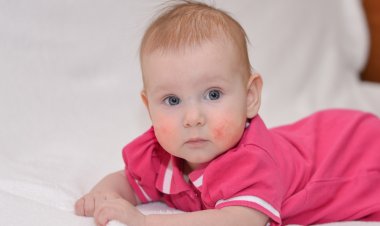 Alerjisi Olan Bebekte Neler Görülür?
