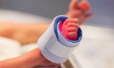 500 Binde Bir Görülüyor! Karnında İkizinin Fetüsüyle Dünyaya Geldi