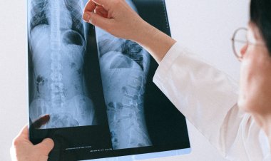 Koronavirüs Hasta Kadının Vücudunda 40 kez Mutasyona Uğradı