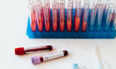 İngiltere'de Halkın Antikor Düzeyi Test Edilecek