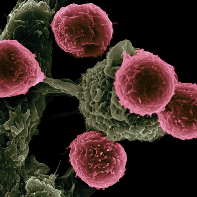 Her Gün 1 Milyon Kanser Hücresiyle Savaştığınızı Biliyor Muydunuz?