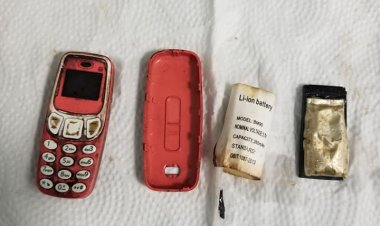 Hastanın Midesinden Ameliyatla Nokia 3310 Çıkarıldı