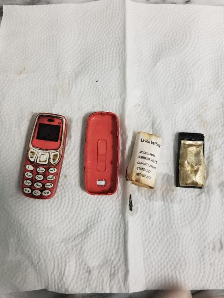 Hastanın Midesinden Ameliyatla Nokia 3310 Çıkarıldı