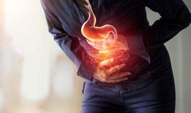 Mide Kanseri İçin 12 Risk: En Çok A Kan Grubunda Görülüyor!