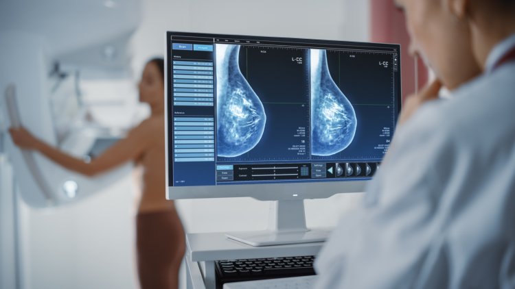 Düzensiz Mamografi Çektirenlerde Yaşam Kaybı Artıyor