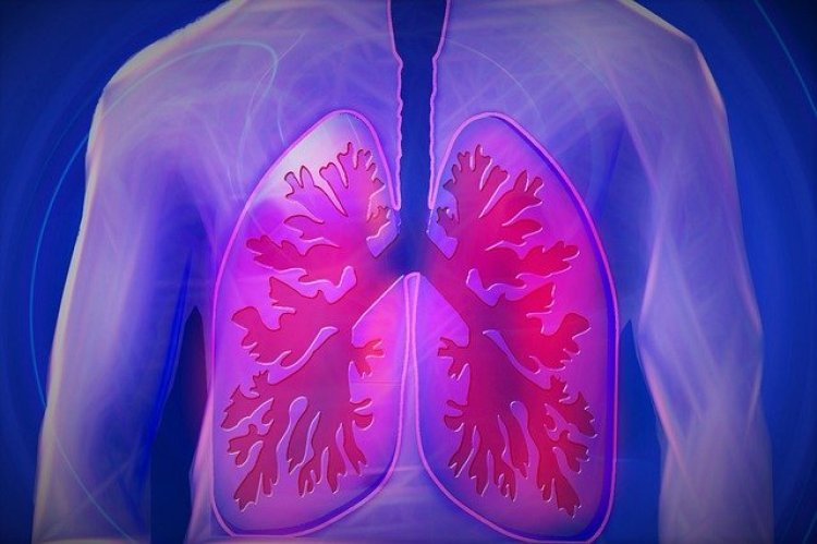 Akciğer Kanserinin İlk Belirtileri Nelerdir? 8 Sinyale Dikkat!