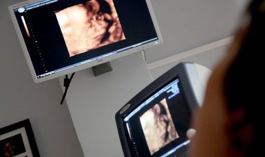 25 Haftalık Bebeğe Anne Karnında Kalp Ameliyatı