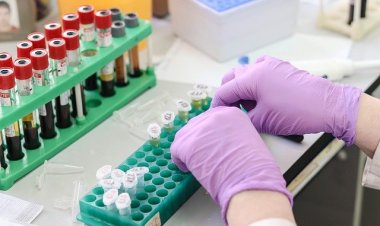 Pfizer, Kanser İlacı Üreticisi Seagen’i 43 Milyar Dolara Satın Aldı