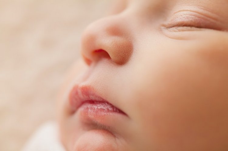 Bebeklerde Yarık Dudak Ve Damak Neden Olur?