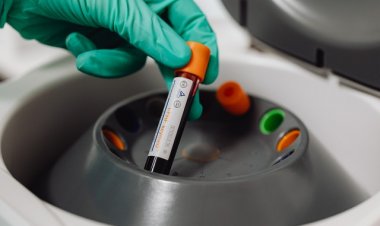 Sepsis (Kan Zehirlenmesi) Nedir, Sepsis Belirtileri Nelerdir?