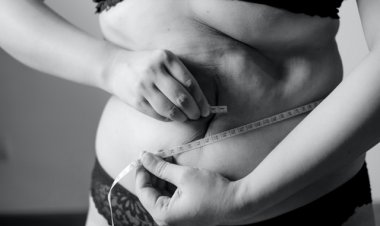 Obezite Cerrahisi Sonrası Kilo Almamak İçin Öneriler!