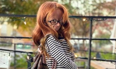 15 Yaşındaki 'Benjamin Button' Öldü