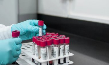 Dünyada İlk Kez Bir Kadın HIV Virüsünden Tamamen Kurtuldu