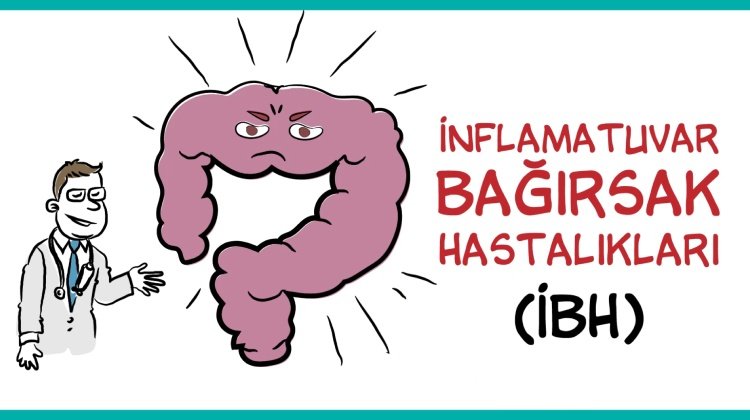 İnflamatuvar Bağırsak Hastalarına Özel Uygulama