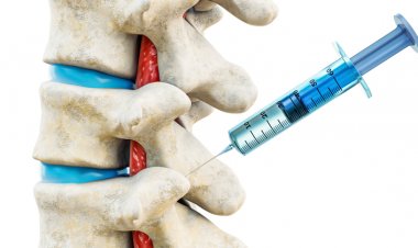 Ağrılardan Kurtulmanın Yeni Yolu: Nöral Terapi