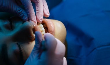 Çarpık Diş Tedavisinde Şeffaf Plak Dönemi