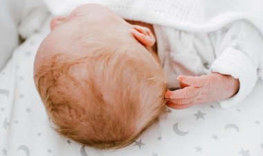 Bebeklerde Kafa Şekil Bozukluğunun 11 Nedeni