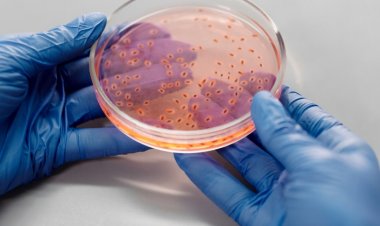 Maymun Çiçeği Virüsü Nasıl Bulaşır? Belirtileri Nelerdir?