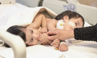 Yapışık İkizler Yeni Hayatlarına Türkiye'de Kavuştu!