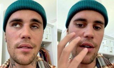 Justin Bieber’ın Yüzünü Felç Eden Ramsay Hunt Sendromu Nedir?