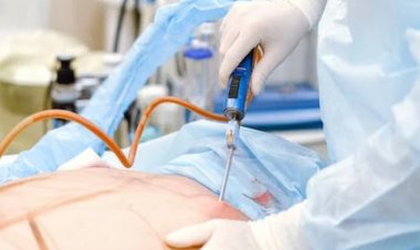 Liposuction ve Abdominoplasti İşlemleri Arasındaki Farklar Nelerdir?