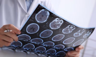 Alzheimer Hastalığının İlk Belirtileri Nelerdir?