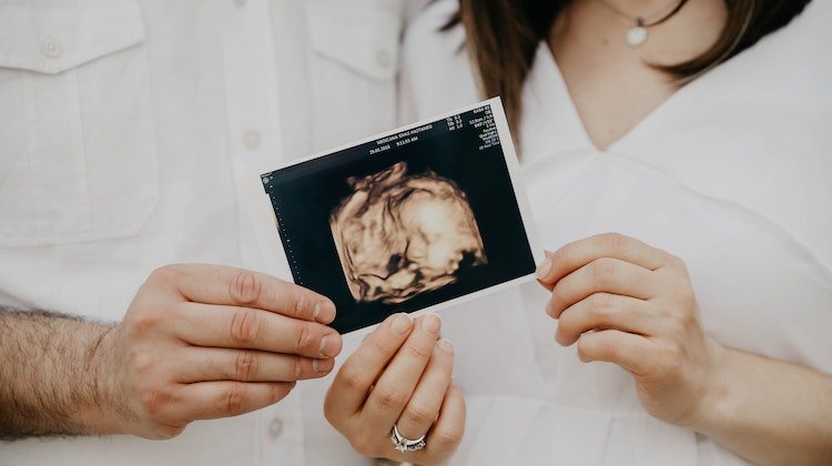 Akrabalık Düzeyi Ne Kadar Yakınsa Fetal Sakatlık Riski O Kadar Yüksek