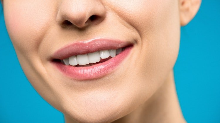 Bembeyaz Dişler Hayal Değil! Diş Beyazlatma İşlemi Nedir, Nasıl Yapılır?