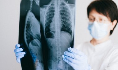 Akciğer Kanseri Ameliyatında Tek Kesi Dönemi