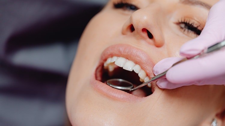 Diş Çürükleri ve Diş Kaybını Önlemek İçin Öneriler
