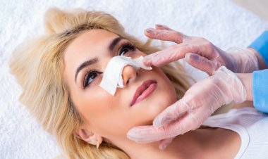 Türkiye En Çok Saç ve Diş Uygulamaları İçin Tercih Ediliyor