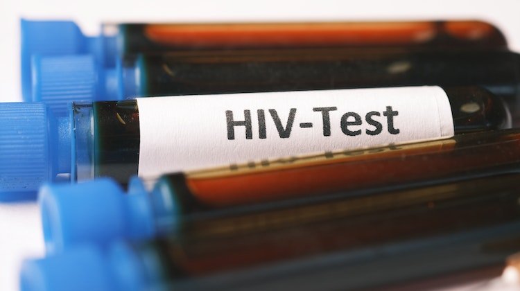 Geliştirme Çalışmalarındaki Tek HIV Aşısı Başarısız Oldu