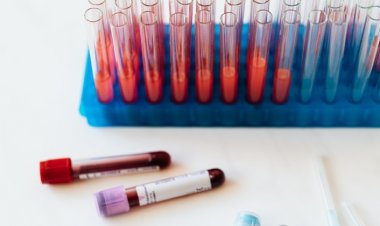 Dünya Talasemi Günü: Evlilik Öncesi Talasemi Testi Neden Önemli?