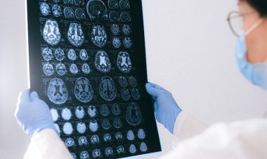 Yapay Zeka Beyin Cerrahisini Dönüştürüyor