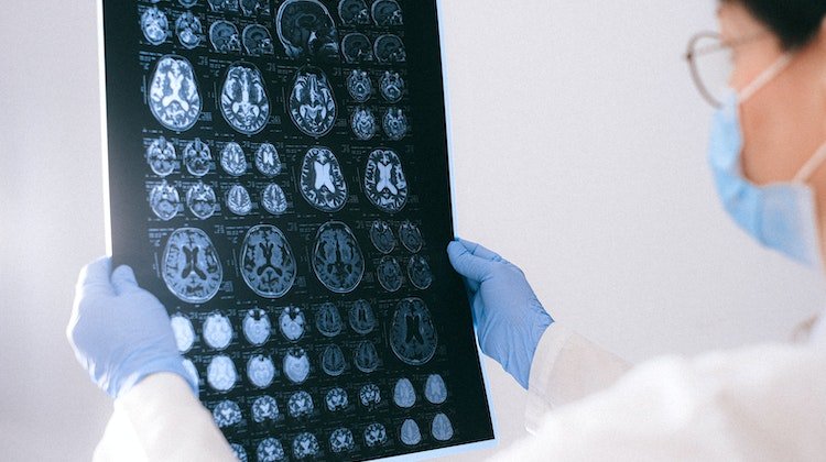 Yapay Zeka Beyin Cerrahisini Dönüştürüyor