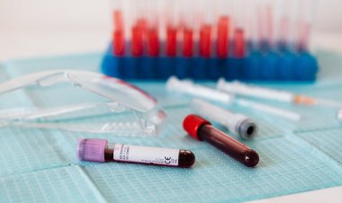 Sepsis Her 3 Saniyede 1 Can Kaybına Neden Oluyor